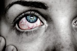 Trockene Augen als Folge nicht idealer Leuftfeuchtigkeit